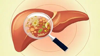 Cómo desintoxicar el hígado de forma natural Cómo desintoxicar el hígado de forma natural