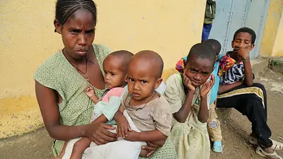 Advertencia de UNICEF: más de 100.000 niños de Etiopía podrían morir de hambre Advertencia de UNICEF: más de 100.000 niños de Etiopía podrían morir de hambre