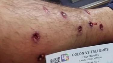 Incidentes en Colón vs Talleres: denuncian que la policía disparó balas de goma