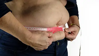 Día Mundial de la Obesidad Día Mundial de la Obesidad