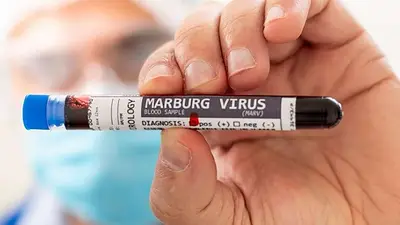 Virus de Marburgo: qué es, cuáles son los síntomas y cómo se contagia Virus de Marburgo: qué es, cuáles son los síntomas y cómo se contagia