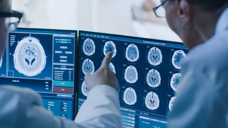 Qué es un edema cerebral, el cuadro por el que murió la joven que consumió éxtasis en Córdoba