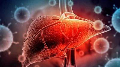 Día Mundial contra las Hepatitis: más de la mitad de las personas desconocen que la padecen Día Mundial contra las Hepatitis: más de la mitad de las personas desconocen que la padecen