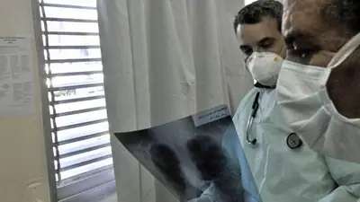 Confirman muerte por faringitis aguda en San Luis Confirman muerte por faringitis aguda en San Luis