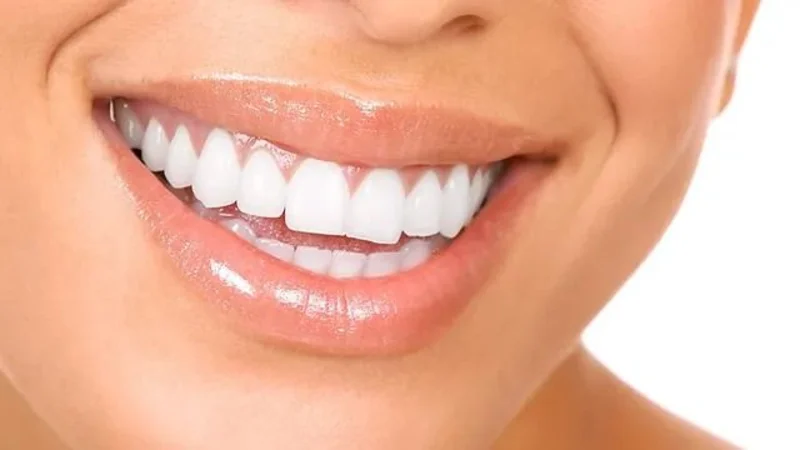 Dientes blancos