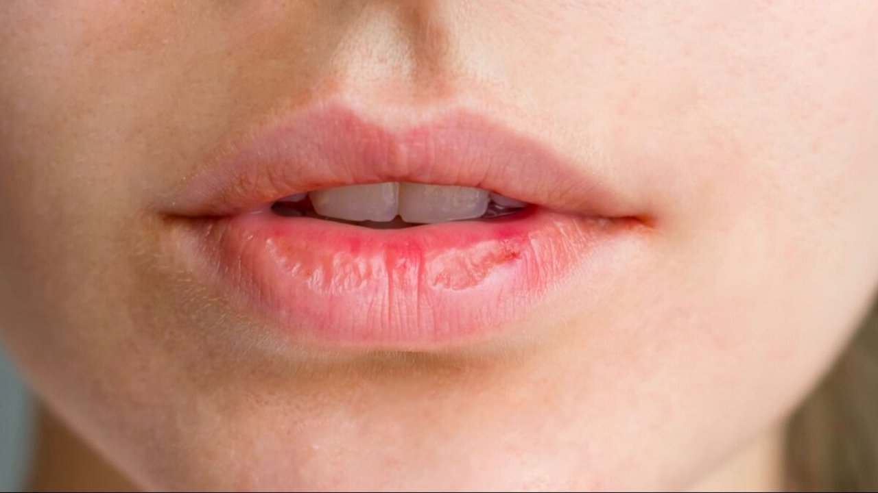 Cuál es mejor método para cuidar los labios. Mejor producto para cuidar los labios agrietados. Vaselina para los labios cuál es la mejor opción.