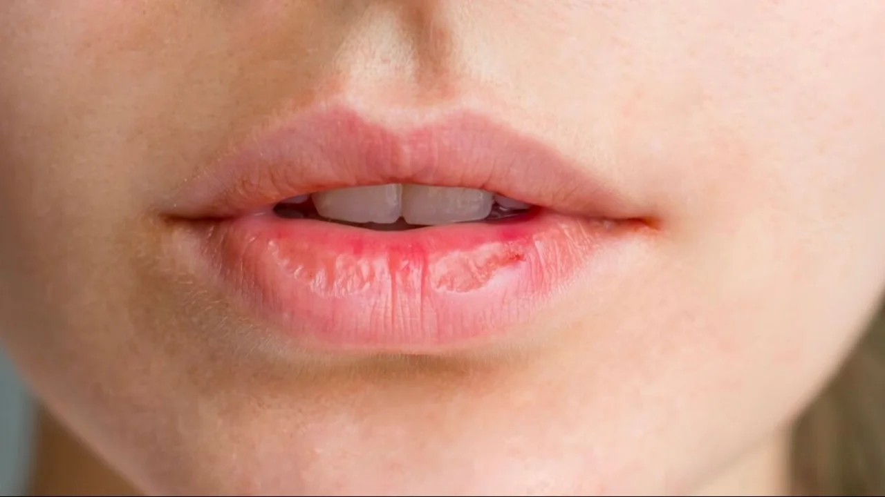 Cuál es mejor método para cuidar los labios. Mejor producto para cuidar los labios agrietados. Vaselina para los labios cuál es la mejor opción.