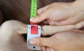 Morir de hambre de bebé: ya son "miles" los casos reportados por UNRWA | Franja de gaza