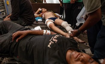 Afirman que al día 10 niños pierden una o dos piernas | Franja de gaza