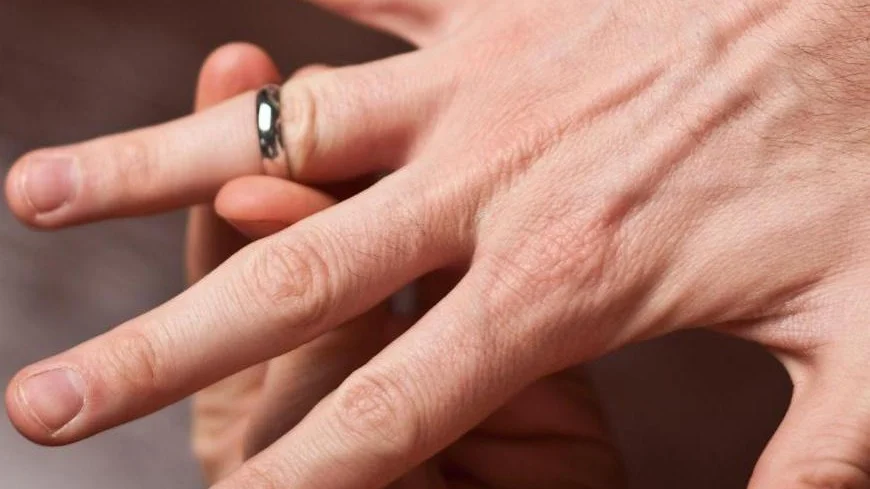 anillo, consejos de salud, anillos, mano, dedo