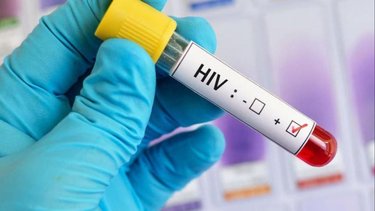 Reconocimiento de la OMS a una estrategia desarrollada en la Argentina para el VIH-sida