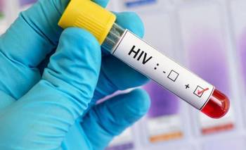 La OMS reconoce una estrategia desarrollada en la Argentina para el VIH-sida | Ciencia 