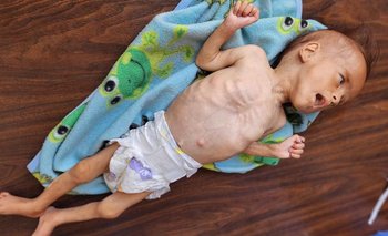 Un bebé de 35 días murió de hambre en un hospital de Gaza por el bloqueo israelí | Franja de gaza