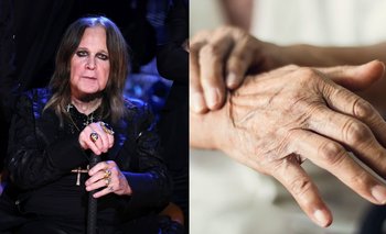 Qué es y qué síntomas tiene el mal de Parkinson | Salud
