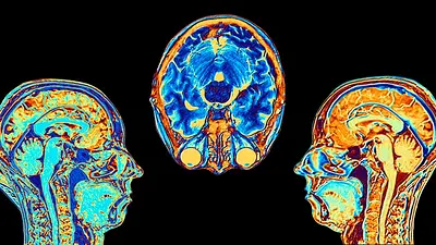 Estudio científico cerebro personas optimistas y personas pesimistas Estudio científico cerebro personas optimistas y personas pesimistas