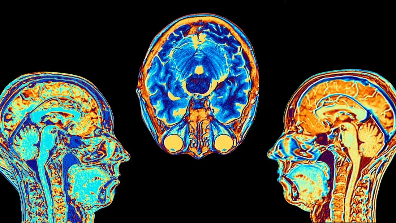 Estudio científico cerebro personas optimistas y personas pesimistas