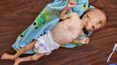 Desesperación y muerte en Gaza: Israel niega la hambruna que provocó y el mundo se queda en palabras