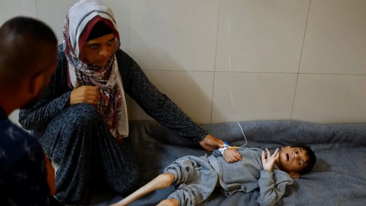 Gaza se está quedando sin alimentos especializados para salvar a niños desnutridos