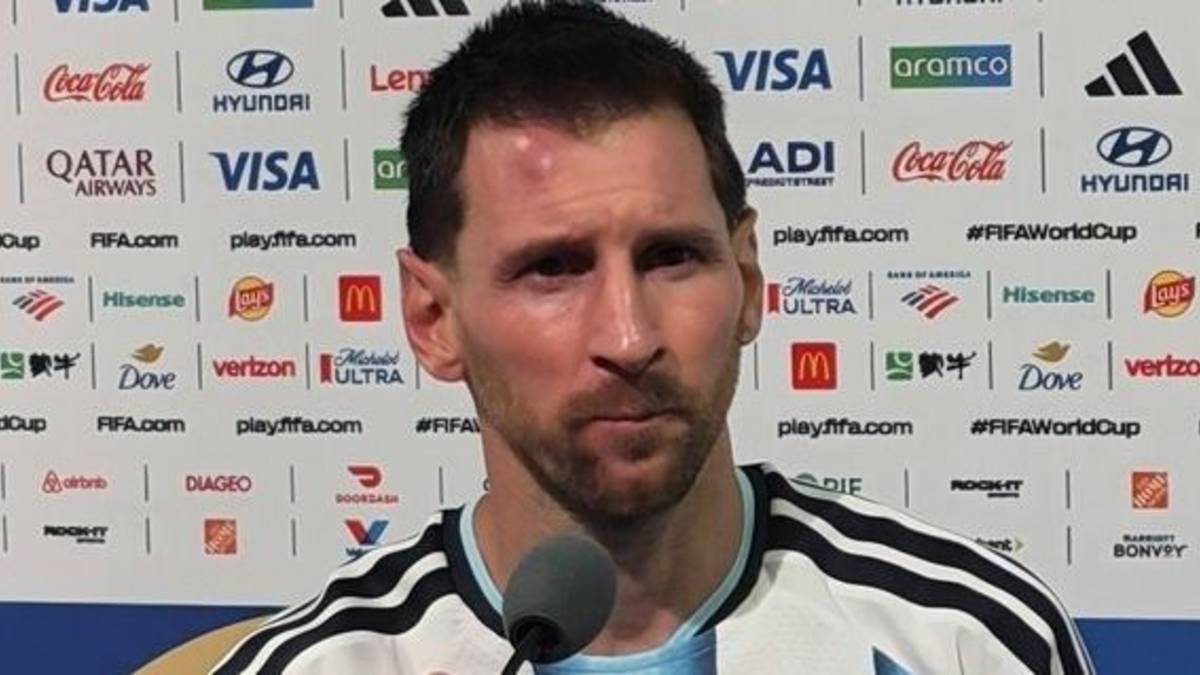 La imagen de Messi con la cara hinchada que preocupó en la Selección Argentina tras Cabo Verde