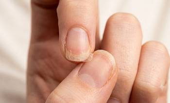 Por qué tus uñas se vuelven más frágiles a partir de los 40 años  | Belleza