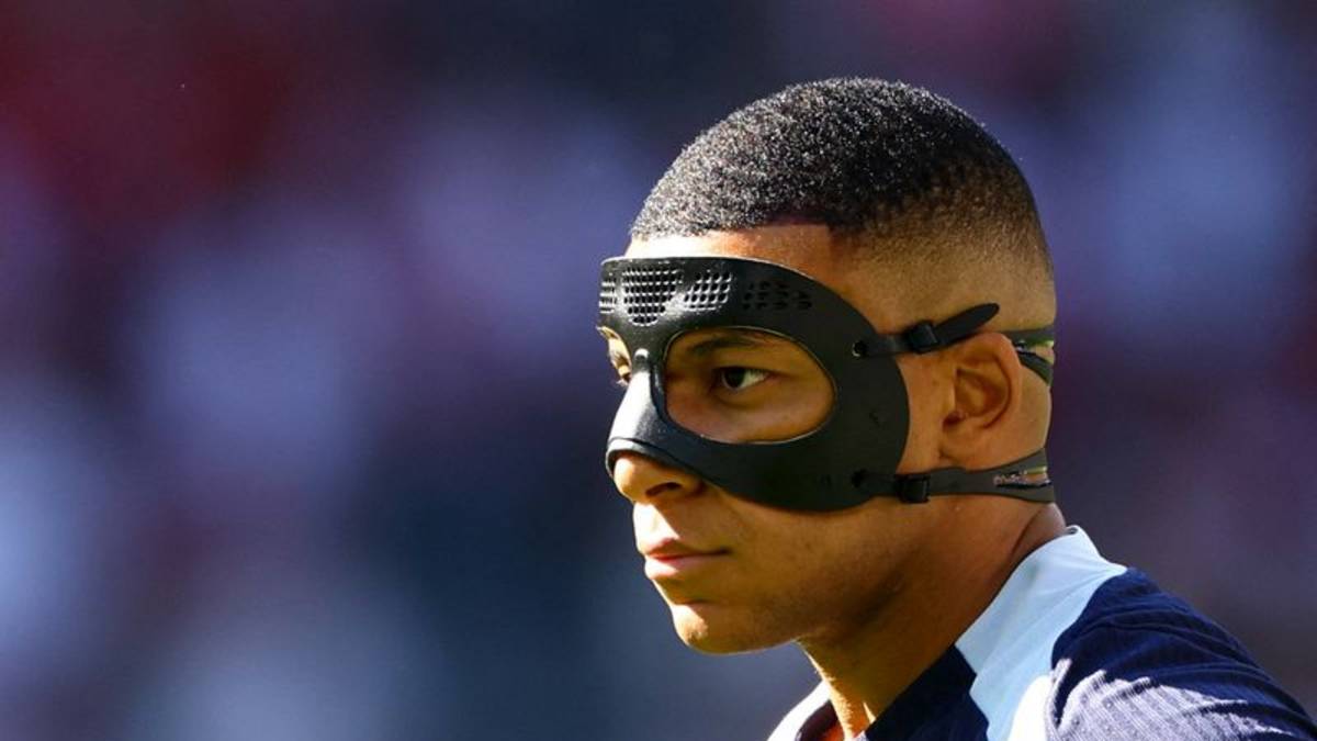 Futbolistas enmascarados en Mundial ponen de relieve riesgo de lesiones faciales, que suele pasarse por alto