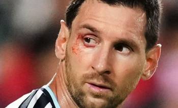La autocrítica de Messi antes de enfrentar a Inglaterra: "Nos metimos atrás" | Selección argentina
