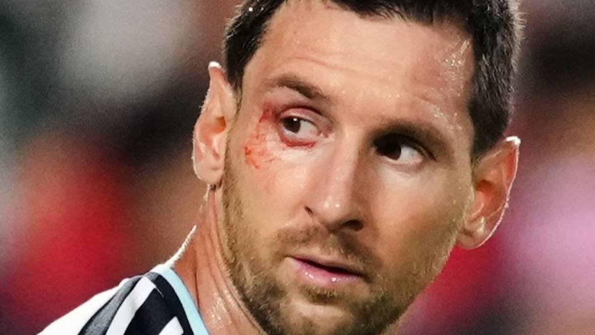"Nos metimos atrás": la fuerte autocrítica de Messi antes de su primer cruce con Inglaterra