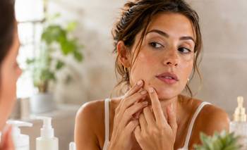 Los granitos en la adultez existen: la rutina beauty que ayuda a controlarlos | Belleza