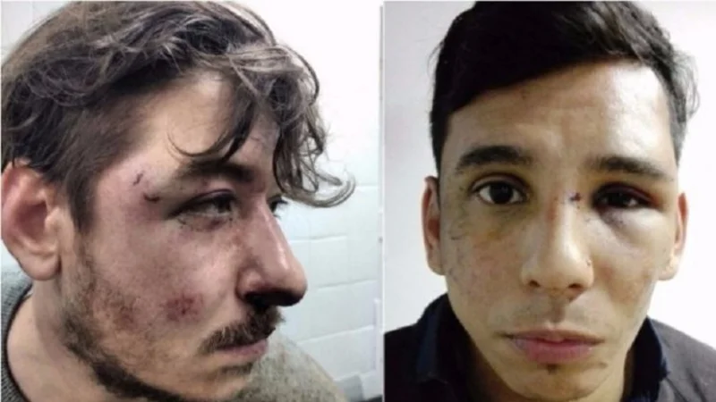 Imágenes del horror: así dejó la policía de Larreta a dos jóvenes por discutir sobre política