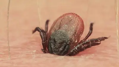 Un nuevo virus transmitido por garrapatas ya provocó siete muertes en China Un nuevo virus transmitido por garrapatas ya provocó siete muertes en China