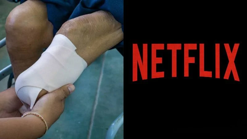 Le amputaron una pierna a un reconocido actor de Netflix