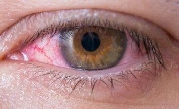 El descubrimiento científico para curar los ojos secos  | Salud