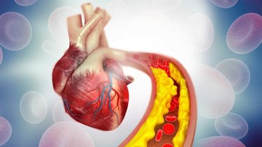 Colesterol: por qué ya no hay que diferenciar entre el "bueno" y "malo"