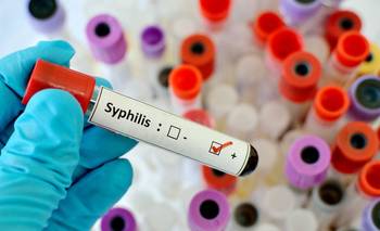 Sífilis en ascenso: alerta por el aumento de casos y las edades afectadas  | Enfermedades