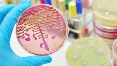 Las medidas a tener en cuenta para disminuir la resistencia antimicrobiana Las medidas a tener en cuenta para disminuir la resistencia antimicrobiana
