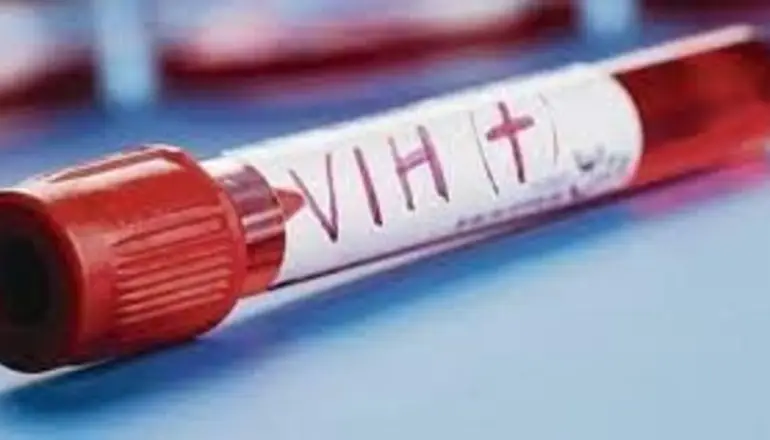 VIH: Descubren mecanismo molecular que explica cómo se perpetúa en reservorios