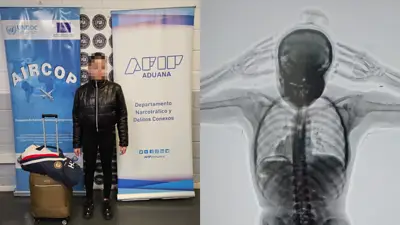 Alerta en Ezeiza. Detienen a una mula con 78 cápsulas de cocaína en su cuerpo. Alerta en Ezeiza. Detienen a una mula con 78 cápsulas de cocaína en su cuerpo.