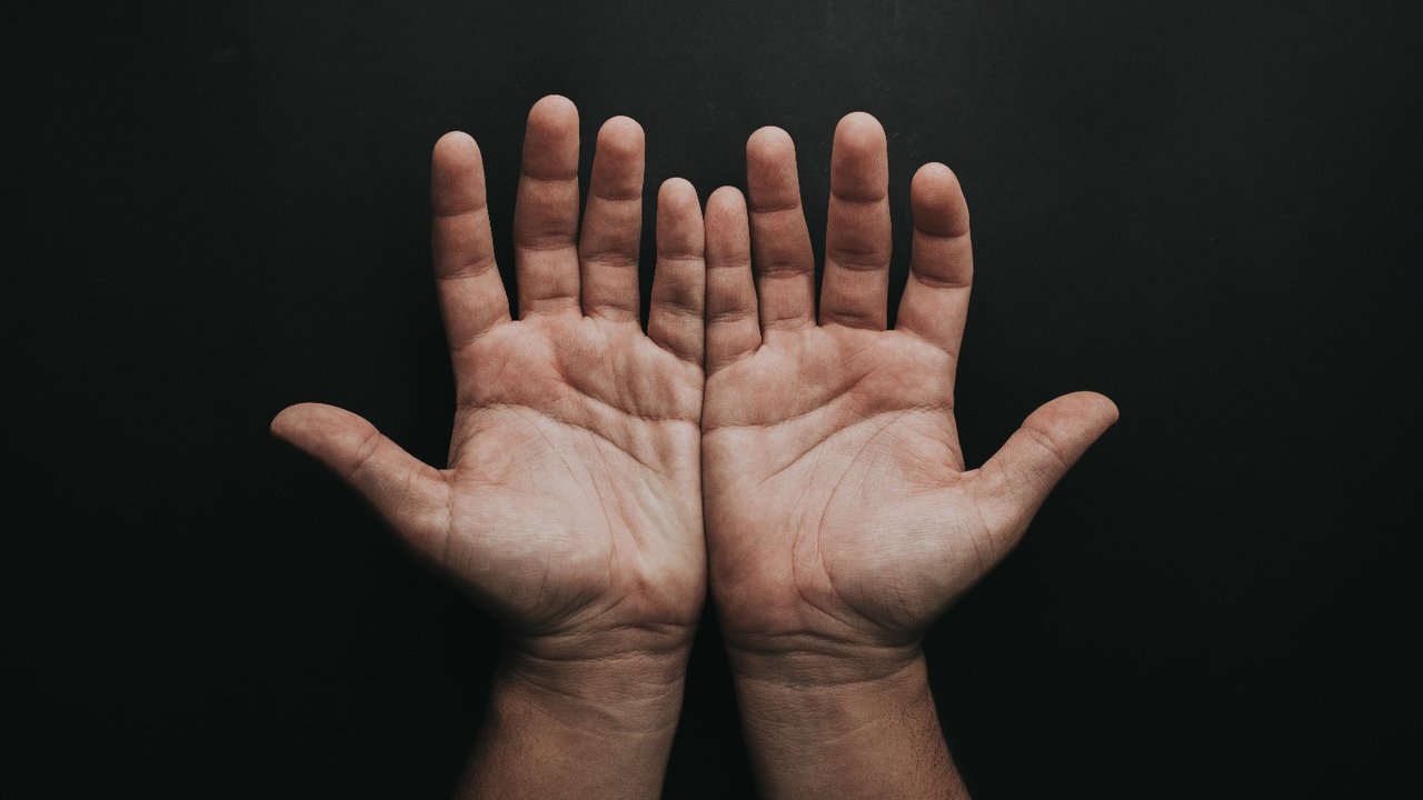  Especialistas de un hospital privado porteño reconstruyeron la mano de un joven al implantarle tres dedos de sus pies.
