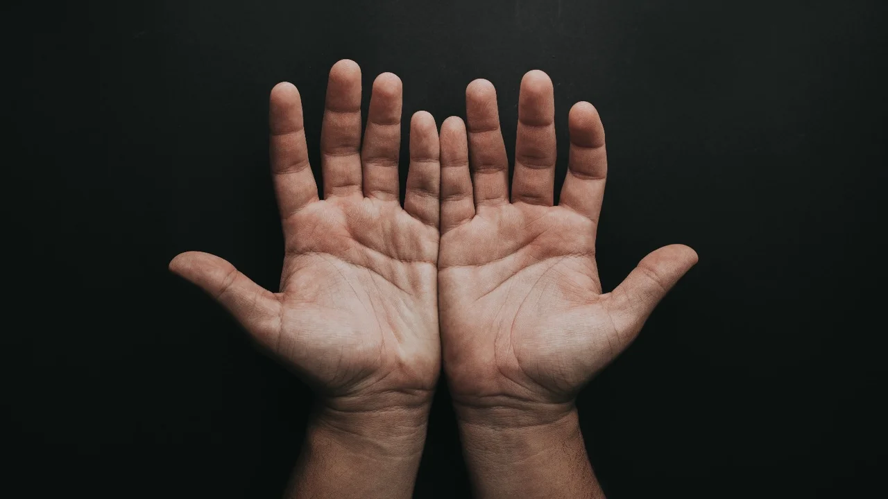  Especialistas de un hospital privado porteño reconstruyeron la mano de un joven al implantarle tres dedos de sus pies.