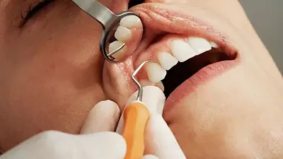 Implantes dentales: la advertencia de los expertos antes de colocarte uno Implantes dentales: la advertencia de los expertos antes de colocarte uno