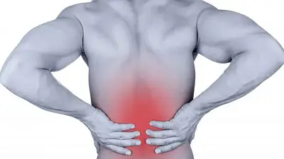 Dolor ciatico. Dolor ciatico.