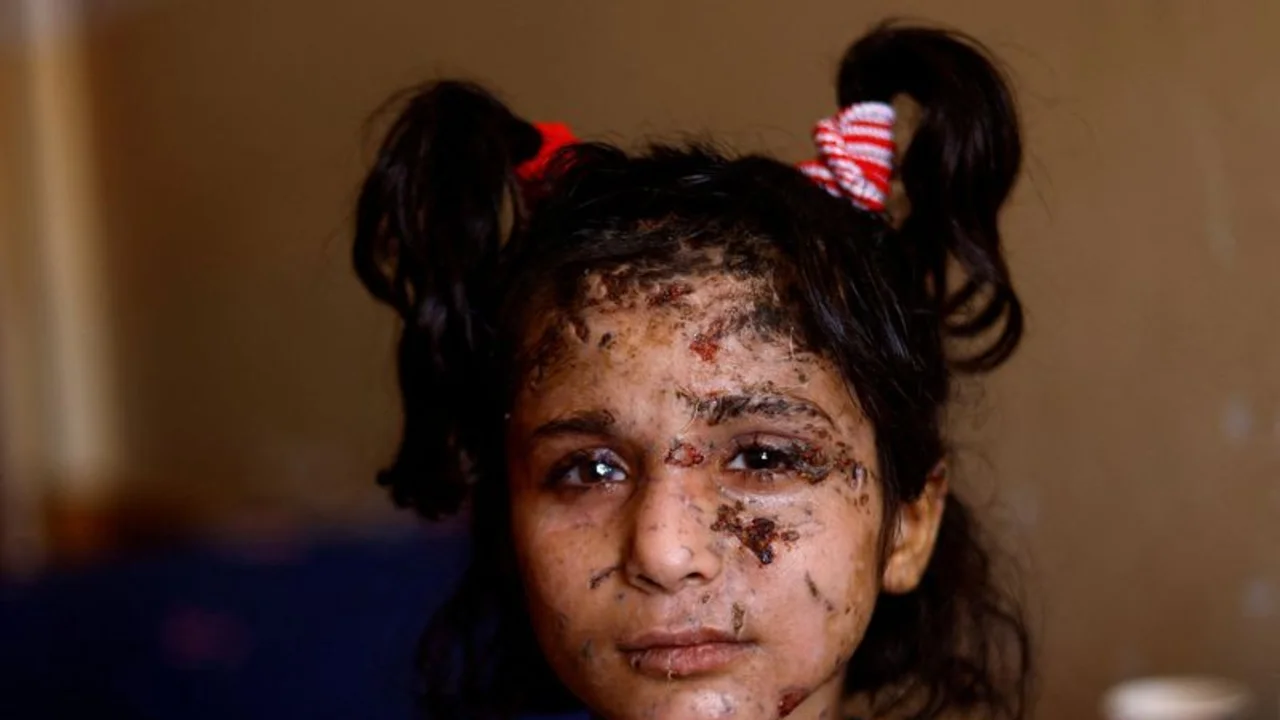 La metralla y la ceguera privan a una joven de Gaza de sus grandes sueños
