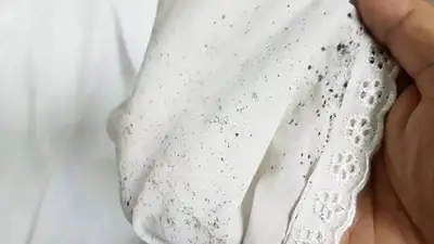 Moho de la ropa Moho de la ropa
