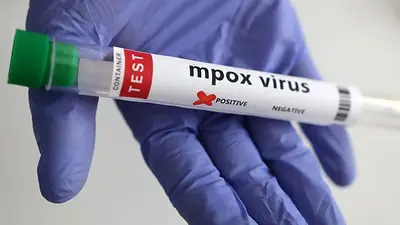 OMS: socios pueden empezar a comprar vacunas contra viruela símica antes de aprobación OMS: socios pueden empezar a comprar vacunas contra viruela símica antes de aprobación