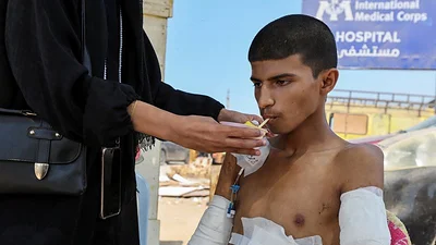 Un adolescente amputado en Gaza recuerda la pesadilla de perder los brazos en un ataque israelí Un adolescente amputado en Gaza recuerda la pesadilla de perder los brazos en un ataque israelí
