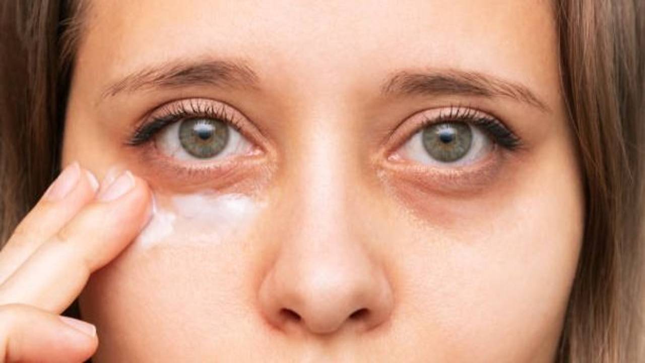 Qué son las ojeras. 