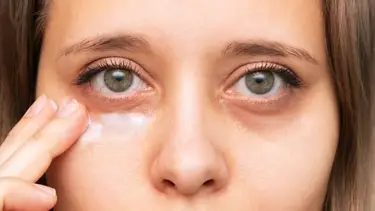 El truco de oro de una dermatóloga para tapar las ojeras y mejorar el contorno de ojos