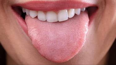 ¿Por qué es necesario limpiar la lengua y cuántas veces al día?