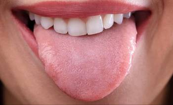¿Por qué es necesario limpiar la lengua y cuántas veces al día? | Consejos de salud