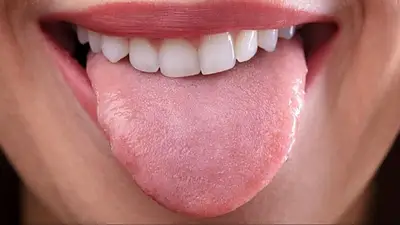 lengua, limpieza bucal, higiene bucal, dientes lengua, limpieza bucal, higiene bucal, dientes